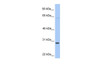 Antibody used in WB on Human HeLa at 0.2-1 ug/ml.