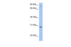 Antibody used in WB on Human Jurkat 0.2-1 ug/ml.