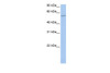 Antibody used in WB on Human Jurkat 0.2-1 ug/ml.