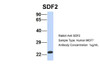 Antibody used in WB on Human MCF7 at 1 ug/ml.