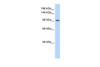 Antibody used in WB on Human HeLa at 0.2-1 ug/ml.