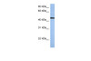 Antibody used in WB on Human HeLa at 0.2-1 ug/ml.