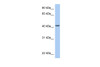 Antibody used in WB on Human HeLa at 0.2-1 ug/ml.