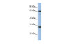 Antibody used in WB on Human Fetal liver at 1 ug/ml.