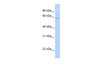 Antibody used in WB on Human 721_B at 0.2-1 ug/ml.