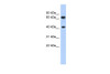 Antibody used in WB on Human THP-1 at 1 ug/ml.