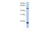 Antibody used in WB on Human HeLa at 0.2-1 ug/ml.