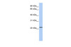 Antibody used in WB on Human Lung at 0.2-1 ug/ml.