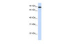 Antibody used in WB on Human Muscle at 0.2-1 ug/ml.