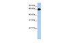 Antibody used in WB on Human Lung at 0.2-1 ug/ml.