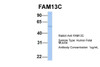 Antibody used in WB on Hum. Fetal Muscle at 1 ug/ml.