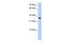 Antibody used in WB on Human HepG2 at 0.2-1 ug/ml.