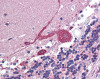 Antibody used in IHC on Human Brain at of 5 ug/ml.