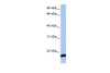 Antibody used in WB on Human MCF7 cells at 0.2-1 ug/ml.