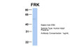 Antibody used in WB on Hum. Adult Placenta at 1 ug/ml.