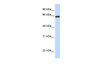 Antibody used in WB on Human Placenta at 0.2-1 ug/ml.