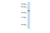 Antibody used in WB on Human Liver at 0.2-1 ug/ml.