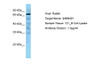 Antibody used in WB on Human 721_B at 0.2-1 ug/ml.