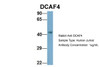 Antibody used in WB on Human Jurkat 1 ug/ml.