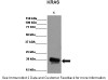 Antibody used in WB on candida albicans Ras1P at: 1:5000.