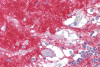 Antibody used in IHC on Human Brain at 5 ug/ml.