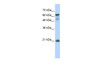 Antibody used in WB on Transfected 293T at 0.2-1 ug/ml.