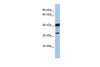 Antibody used in WB on Human MCF-7 at 0.2-1 ug/ml.