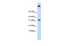 Antibody used in WB on Human MCF-7 at 0.2-1 ug/ml.