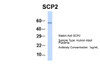 Antibody used in WB on Hum. Adult Placenta at 1 ug/ml.