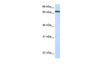 Antibody used in WB on Human 293T at 0.2-1 ug/ml.