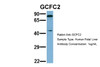 Antibody used in WB on Hum. Fetal Liver at 1 ug/ml.