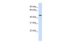 Antibody used in WB on Human Liver at 0.2-1 ug/ml.