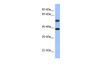 Antibody used in WB on Human MCF-7 at 0.2-1 ug/ml.