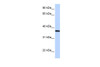 Antibody used in WB on Human Heart at 0.2-1 ug/ml.