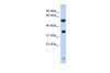 Antibody used in WB on Human Brain at 0.2-1 ug/ml.