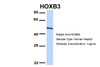 Antibody used in WB on Human MCF7 at 1 ug/ml.