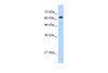 Antibody used in WB on Human Jurkat cells at 1.25 ug/ml.