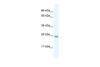 Antibody used in WB on Human Liver at 0.2-1 ug/ml.