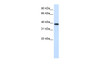 Antibody used in WB on Human kidney at 0.2-1 ug/ml.