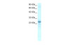 Antibody used in WB on Human Heart lysate at 0.2-1 ug/ml.