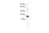 Antibody used in WB on Human Heart lysate at 0.2-1 ug/ml.