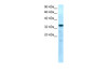 Antibody used in WB on Human Muscle lysate at 0.2-1 ug/ml.