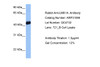 Antibody used in WB on Human 721_B at 1 ug/ml.