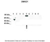 Antibody used in WB on r-SMAD5 at: 1:1000 (Lane 1: 5ug of transfected 293T lysate (SMAD1) , Lane 2: 5ug of transfected 293T lysate (SMAD2) , Lane 3: 5ug of transfected 293T lysate (SMAD3) , Lane 4: 5ug of transfected 293T lysate (SMAD4) , Lane 5: 5ug of transfected 293T lysate (SMAD5) , Lane 6: 5ug of transfected 293T lysate (SMAD6) , Lane 7: 5ug of transfected 293T lysate (SMAD7) , Lane 8: 5ug of transfected 293T lysate (SMAD8) , Lane 9: 5ug of transfected 293T lysate (GFP) ) .