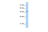 Antibody used in WB on Human HepG2 at 2.5 ug/ml.