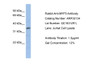 Antibody used in WB on Human Jurkat 1 ug/ml.