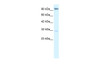 Antibody used in WB on Human HepG2 at 2.5 ug/ml.