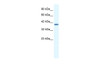 Antibody used in WB on Human HepG2 at 0.2-1 ug/ml.