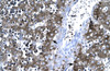 Antibody used in IHC on Human Liver.