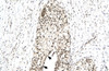 Antibody used in IHC on Human urinary bladder.